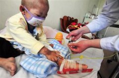 “白血病”兒童增加，甲醛危害值得關(guān)注